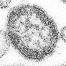 Genetically modified virus to  shrivel/shrink Incurable Cancers.